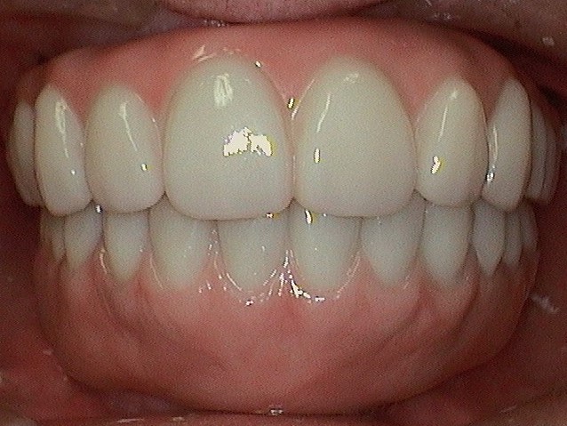 Complete Comfort Dental | Ceramic Crowns, Orthodontics and Sedation Dentistry
