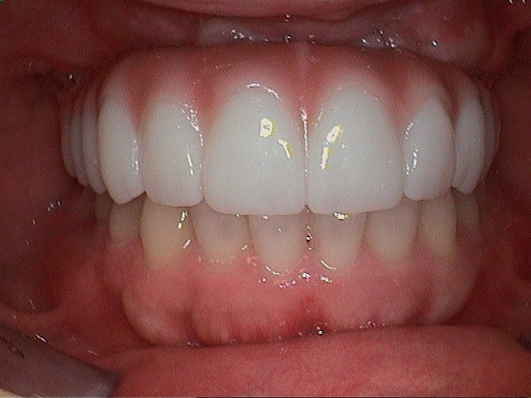 Complete Comfort Dental | Pediatric Dentistry, Periodontal Treatment and VELscope® Cancer Screening