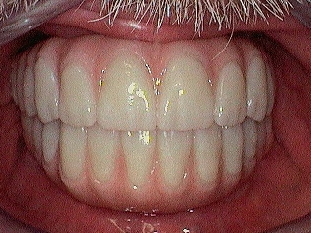 Complete Comfort Dental | Inlays & Onlays, Oral Exams and E4D