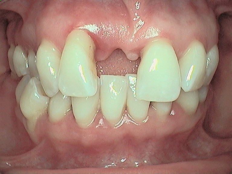 Complete Comfort Dental | Air Abrasion, Juvederm® and Sedation Dentistry
