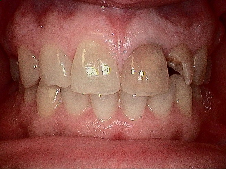 Complete Comfort Dental | Oral Cancer Screening, Cosmetic Dentistry and Botox®